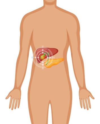 Safra Kesesi Kanseri