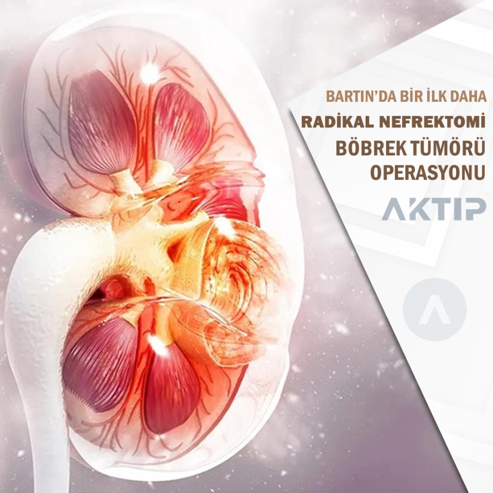 Radikal Nefrektomi: Böbrek Tümörü Operasyonu