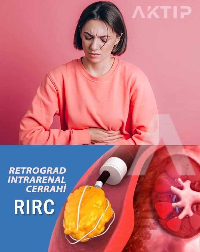 Retrograd İntrarenal Cerrahi Nedir?