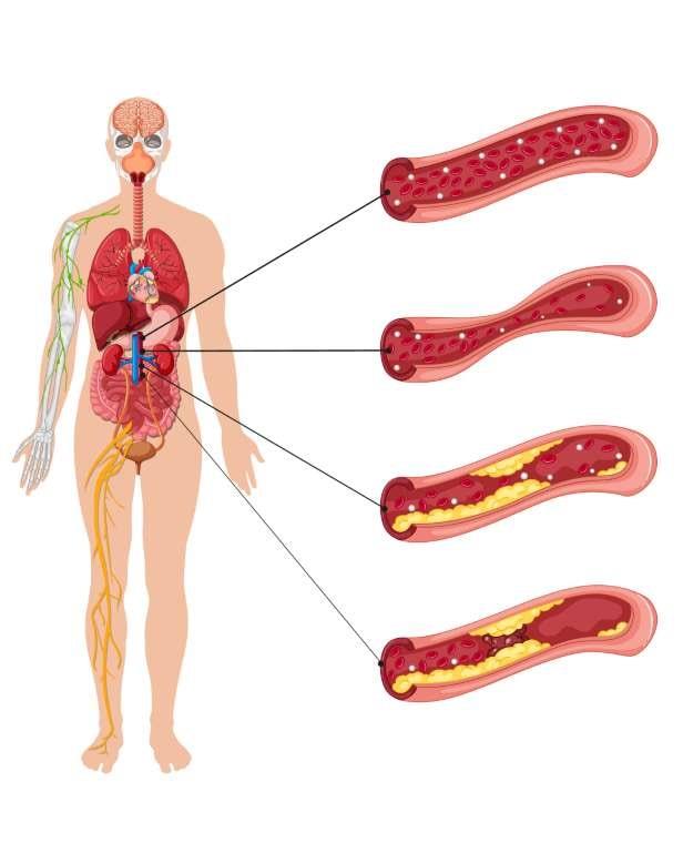 Trigliserid Nedir?